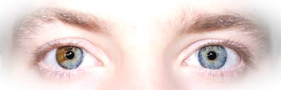 Person with heterochromia (two different colored irises)